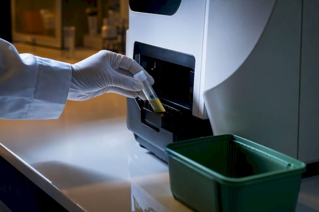 Échantillon d'urine analysé en laboratoire