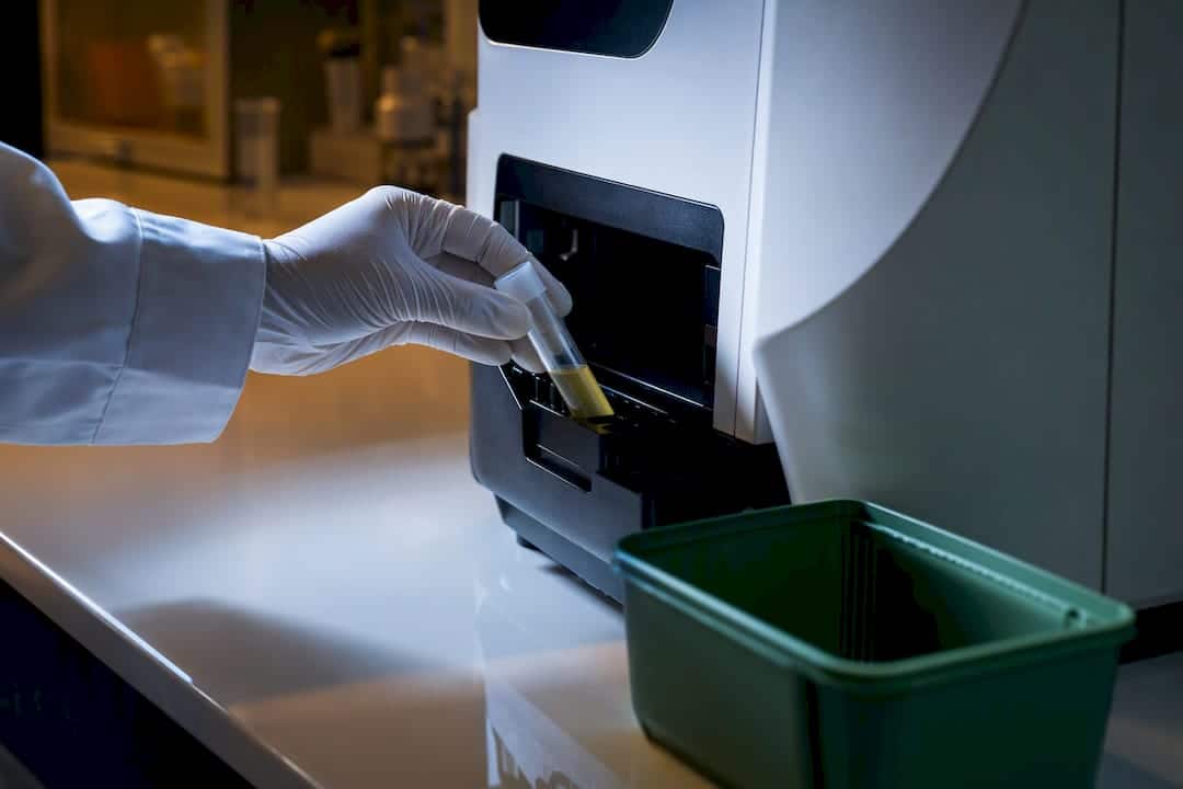 Échantillon d'urine analysé en laboratoire